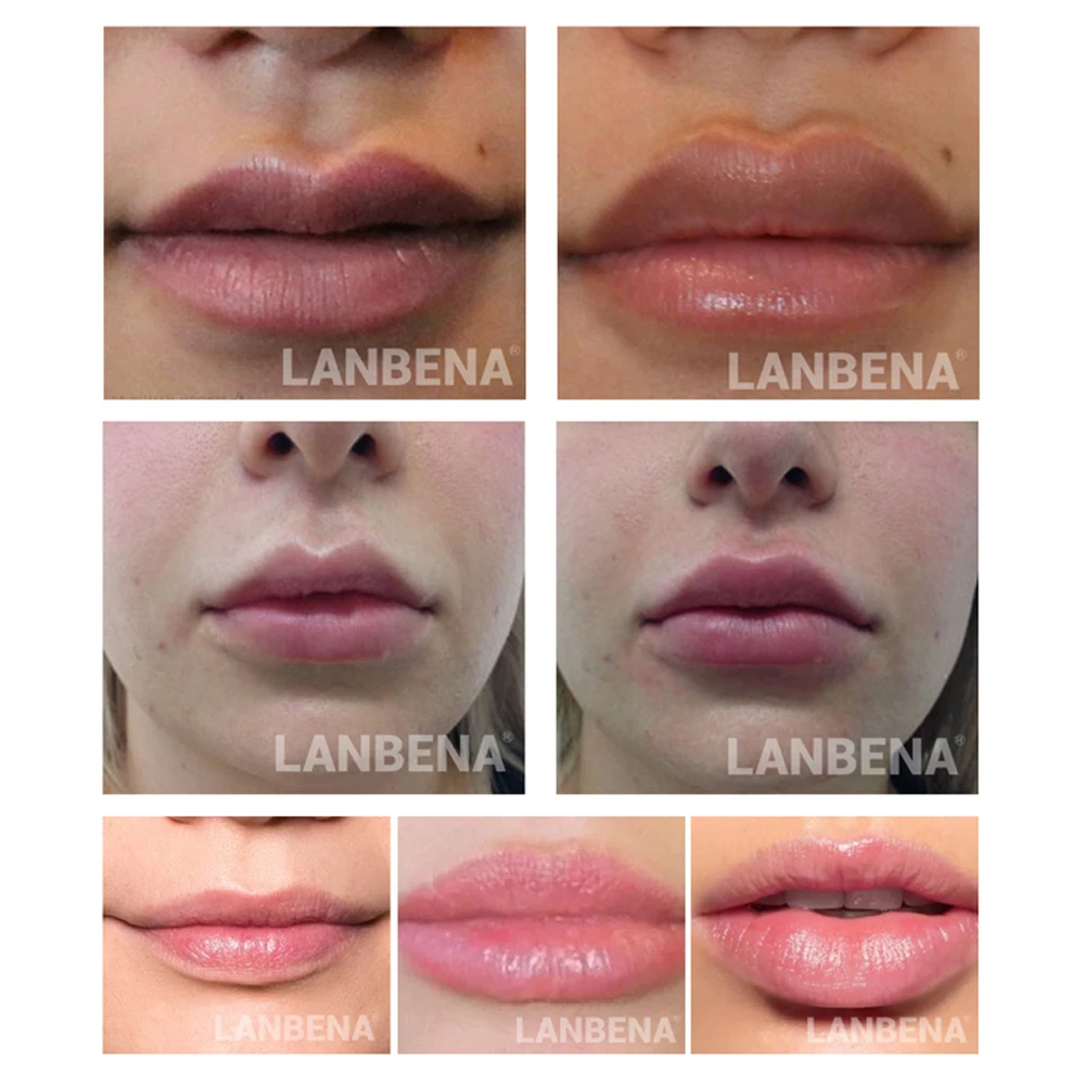 LANBENA Lsoflavone Сыворотка для ухода за губами более полная маска губ повышающая