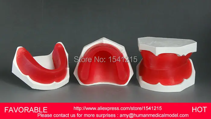 

ORAL MODEL,TEETH ,MANDIBULAR IMPLANT DENTAL MODEL, ORAL TRAINING MODEL ,EDENTULOUS DENTAL WAX MODEL EMBANKMENT-GASEN-DEN024