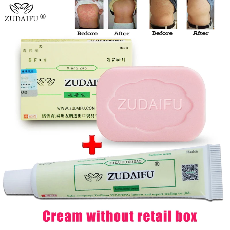 zudaifu psoriasis cream atopic seborrheic dermatitis chinese herbal medicine dyshidrotic eczema skin treatment ointment medicine body self tanners bronzers aliexpress