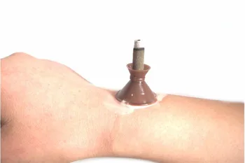 

Moxa meridian acupuncture moxibustion moxa stick moxibustion body micro-smoke tube