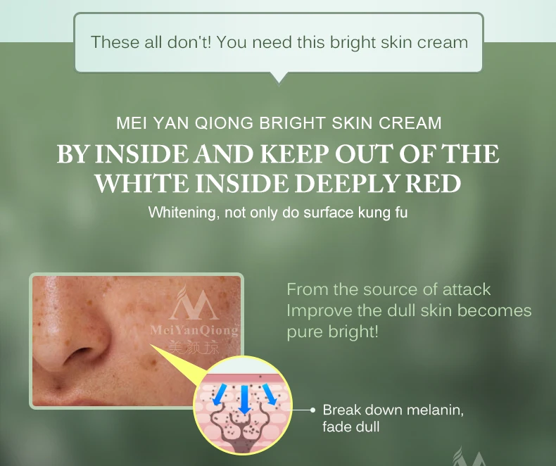 Creme de Sarda. Creme de Cuidados Poderoso Clareamento Remover Melasma Acne Manchas Pigmento Melanina Escuras Rosto 2 Pçs 80g 4 manchas escuras rosto clareamento creme de cuidados