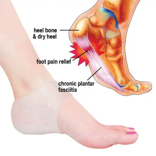 2PCS Protective Silicone PLANTAR FASCIITIS Heel Spur Ankle Gel Support Pain Relief Moisturizing Gel Heel Inserts