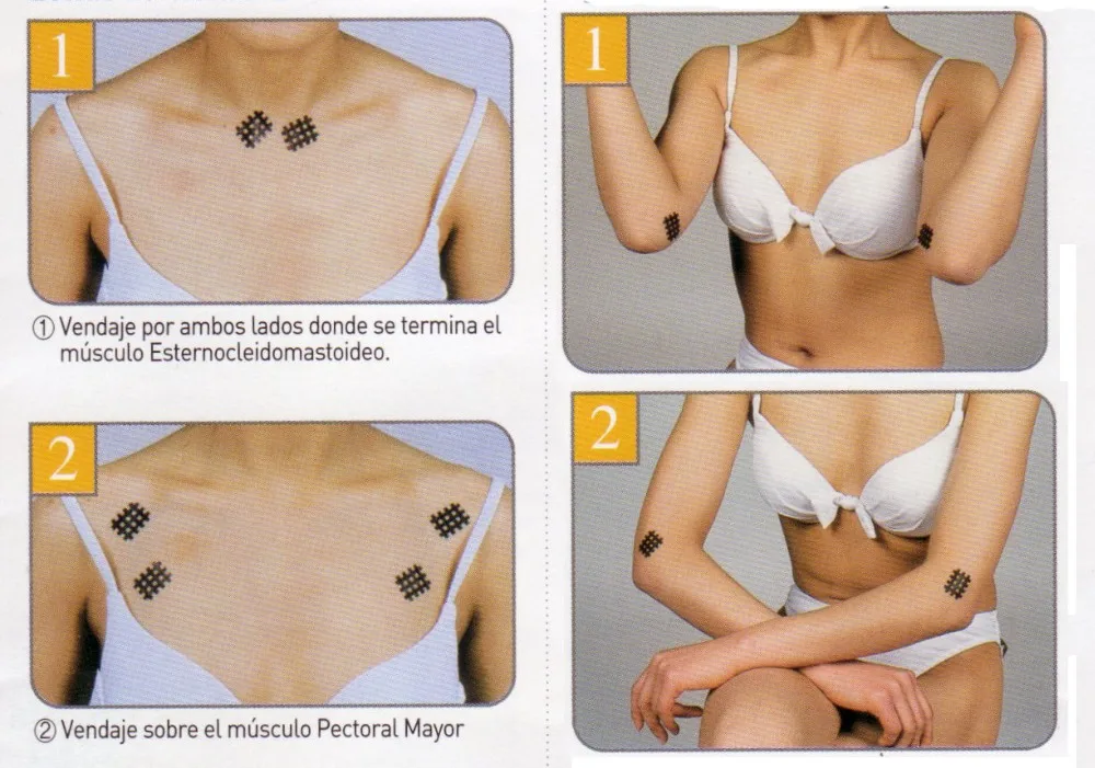 Спиральная перекрестная кинезиологическая лента Macure для терапии (упаковка из 10