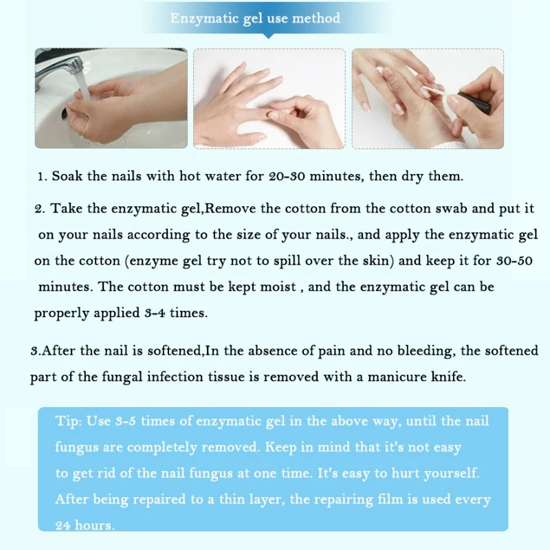 Лечение онихомикоза комплект стерилизации устранить грибок ногтей носком ногтей ремонт сущность противогрибковые для ухода за ногтями