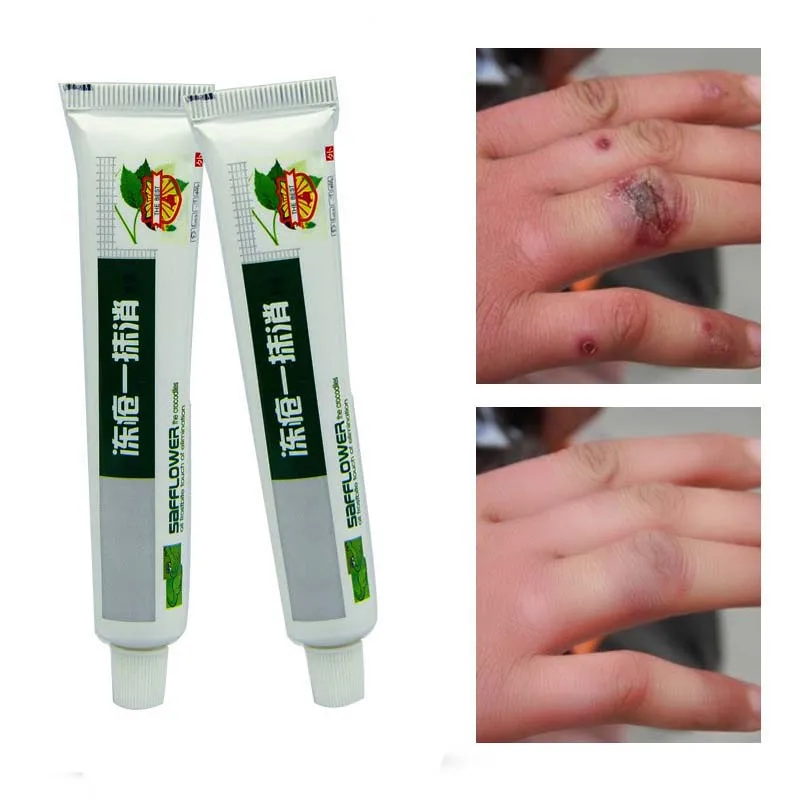 

Winter 25g Chinese Medicinal Ointment Hand Foot Crack Cream Heel Chapped Peeling Repair Frostbite Anti Dry Crack Skin Creams
