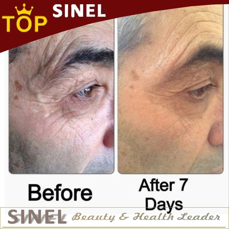 Продвижение мгновенно нестареющий подтяжка лица сыворотки Jeunesse 5 Sachets ageness