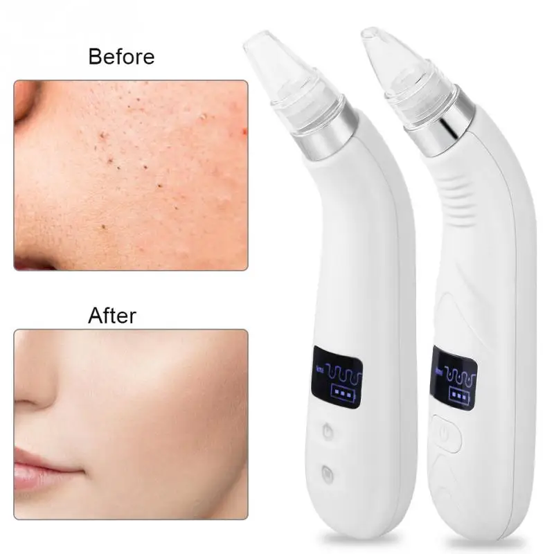 

Electric Blackhead Removal Vacuum Suction Face Pore Cleaner Skin Cleaning Tool