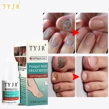 Травяные антибактериальные Лечение грибка для ногтей эфирное масло сыворотка ремонт ноготь пальца ноги грибковое удаление ногтей Крем против инфекции