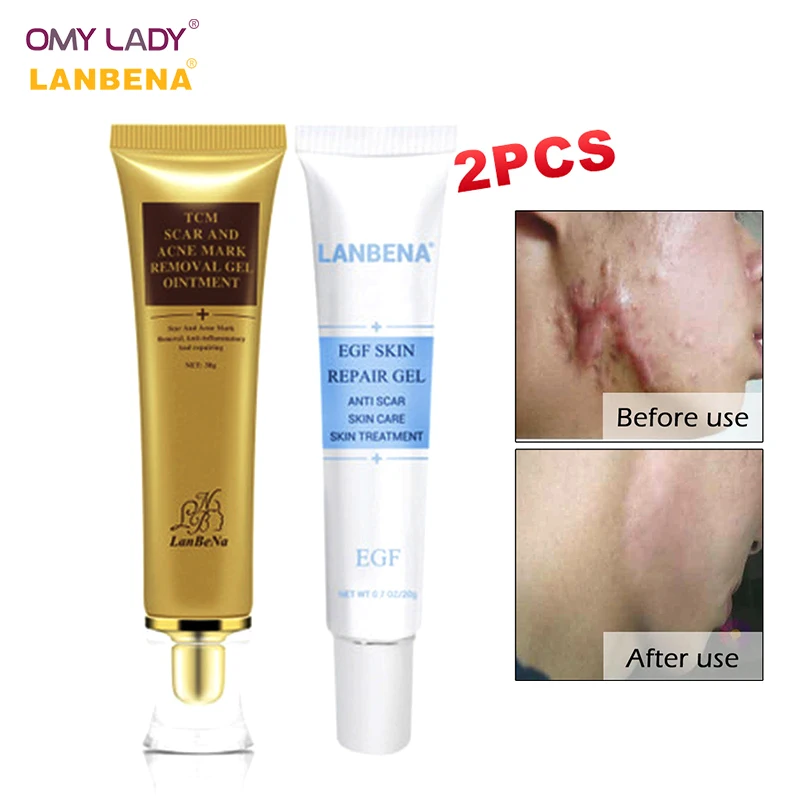 

LANBENA 2PCS tcm scar and acne mark removal gel smooth and tender rough skin moisturizing pigmentation corrector acne scar treat