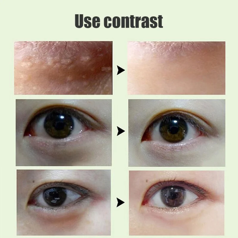 KK0043(9)