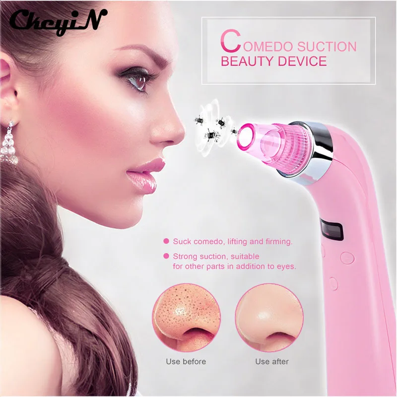 diamond dermabrasie apparaat
