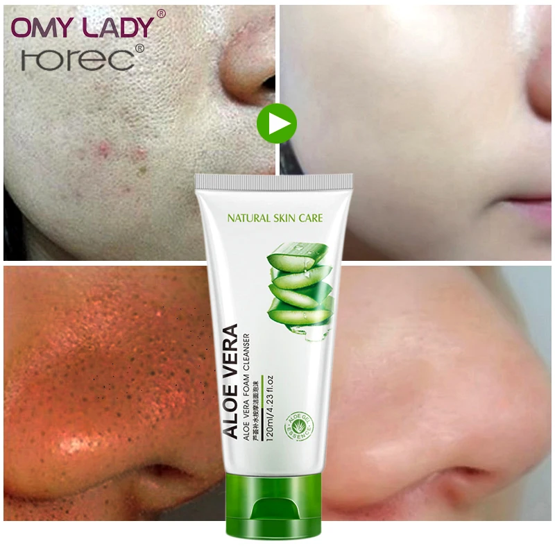 

ROREC Aloe Vera Facial Cleanser Skin Care Plant Extract Collagen Repair Hydrating Oil Control Foam Acne Treatment Shrink Pores