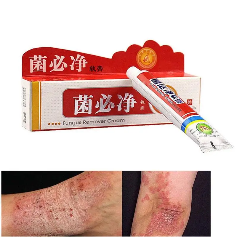 

25g/Box Psoriasis Dermatitis Cream Organic Eczema Skin inflammation Rash Itchy Dry Skin Feet Care Chinese Ointment