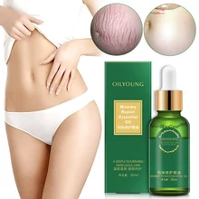 Стрейч Знаки удалить Эфирное Масла против растяжек крем для Удаления растяжек и беременных Масла обработки для беременных уход за кожей