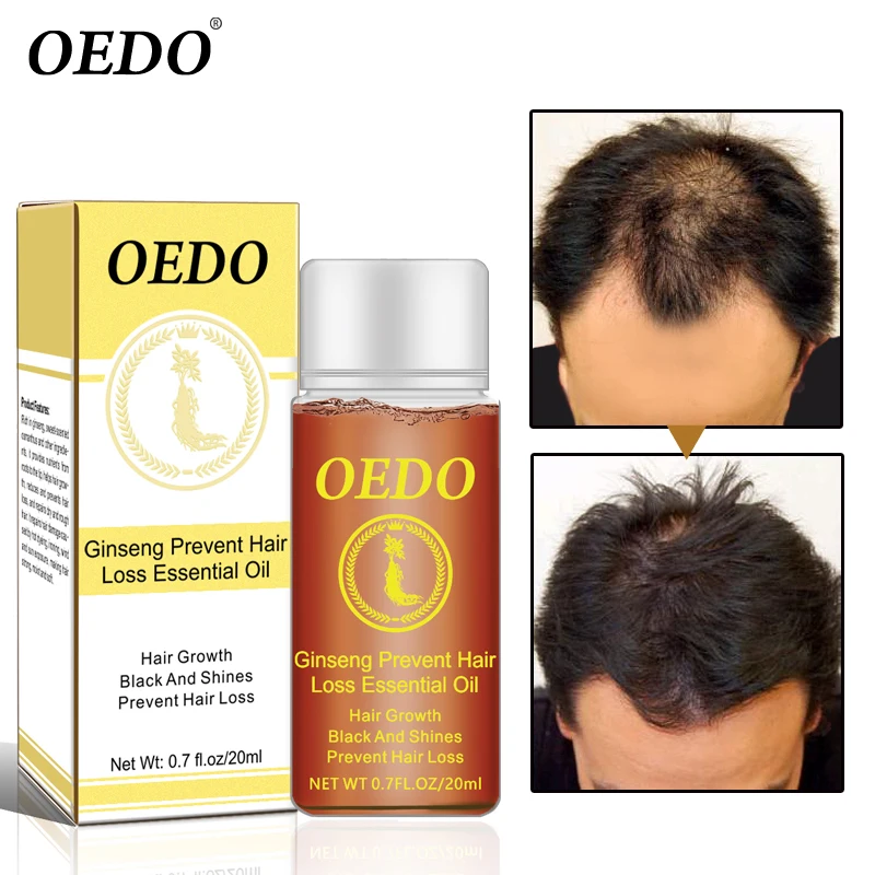 20ML Ginseng Hair Growth Essence Preventing Hair Loss Liquid Damage Hair Repair Treatment Dense Fast Restoration Hair Growth