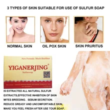 84 г серное мыло, дерматит, гриб, Eczema, антибактериальный гриб, уход за кожей, для ванны, Отбеливающее мыло, SSwell