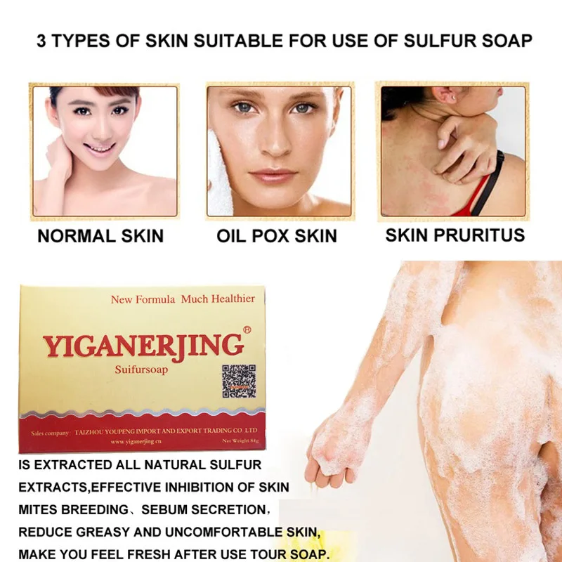 Buy 84g Sulphur Soap Dermatitis Fungus Eczema Anti