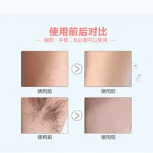 Эссенция для ухода за депиляцией ингибитор роста волос гидратация для тела ног подмышек TY99