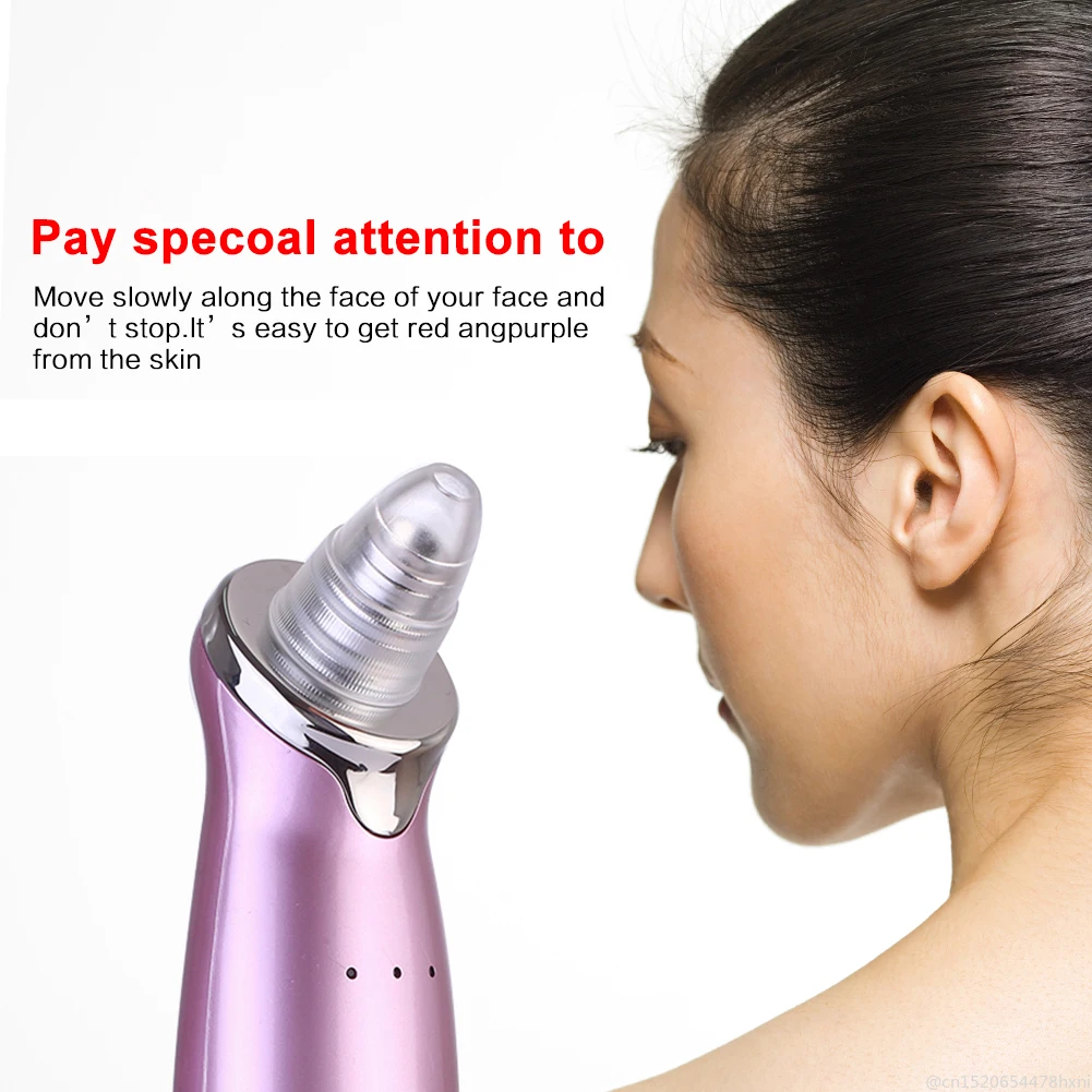 

Electric Vacuum Pore Cleaner Exfoliating Cleansing Suction Pore Cleaner Blackhead Vacuum Suction Acne with 4 Replace Heads