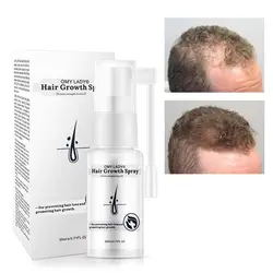 Питательный спрей для роста волос фолликулы кожи головы предотвратить облысение натуральный растительная эссенция Уход за волосами роста