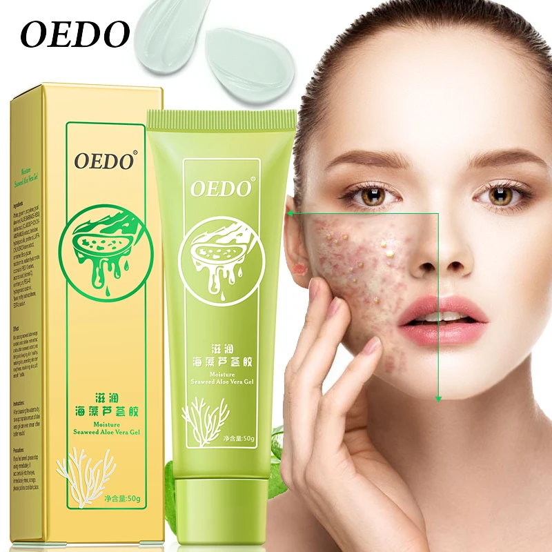 Водоросли алоэ вера гель увлажняющий отбеливающий день кремы Acne антивозрастной