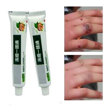 

Winter 25g Chinese Medicinal Ointment Hand Foot Crack Cream Heel Chapped Peeling Repair Frostbite Anti Dry Crack Skin Creams