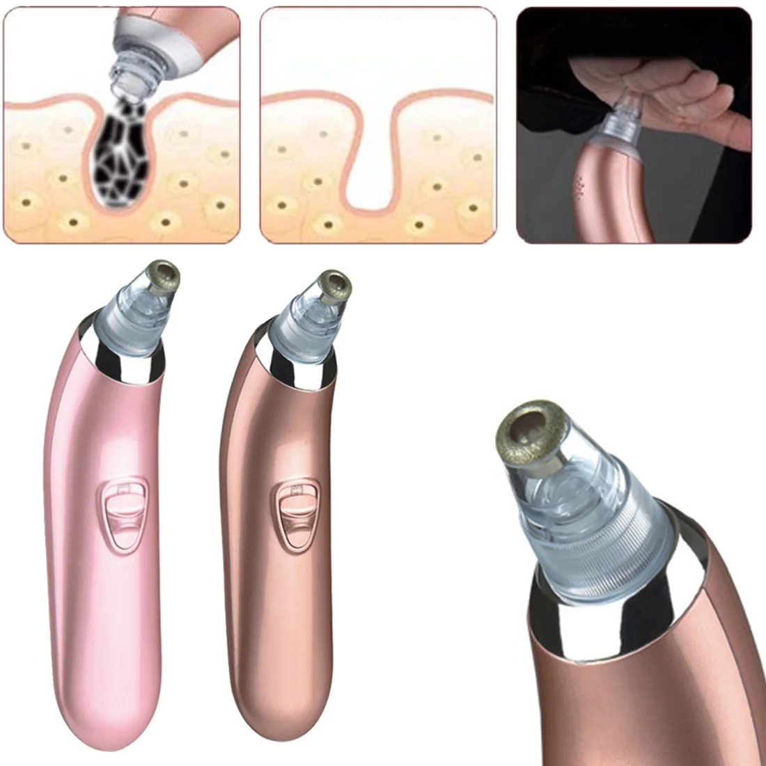 Электрический прибор для удаления пятен/акне/черных точек/вакуумный аппарат для очистки пор/вакуумный всасывающий инструмент для ухода за лицом для девочек/женщин