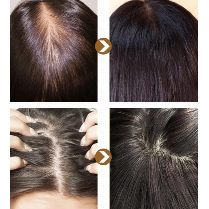 20 мл эссенция для роста волос, органическое кокосовое аргановое масло для лечения волос, продукты для быстрого роста волос, сыворотка