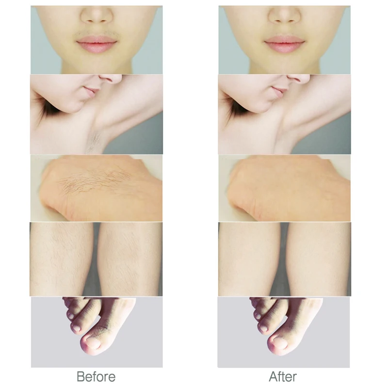 bikini trimmer before after