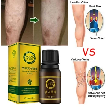 

10ml Wormwood / Ginger / Jojoba Seed Essential Oil Varicose Veins Treatment Vasculitis Leg Acid Itching Herbal Care Ointment New