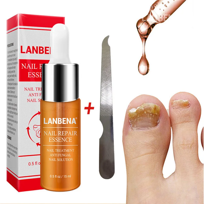 15ml Liquid Fungal Nail Treatment Pen Onychomycosis Paronychia Anti