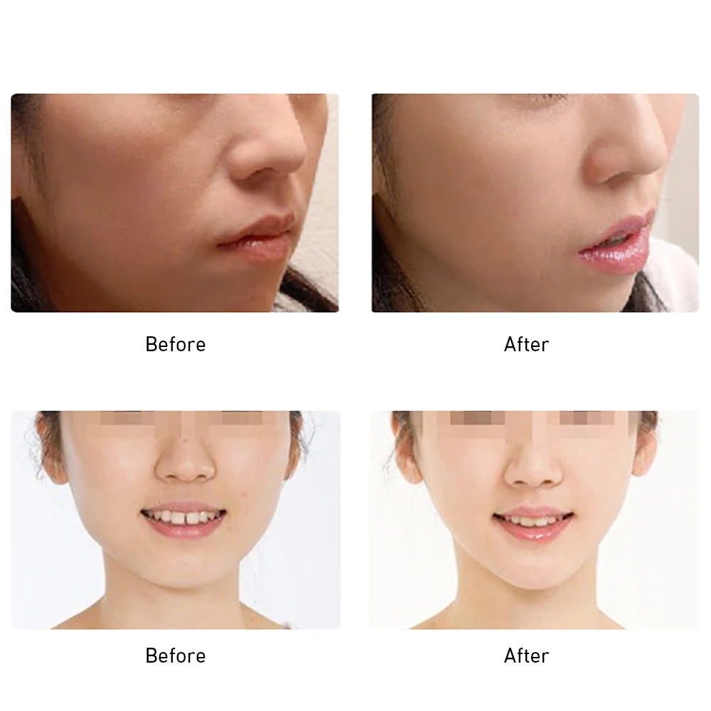 beforeafter