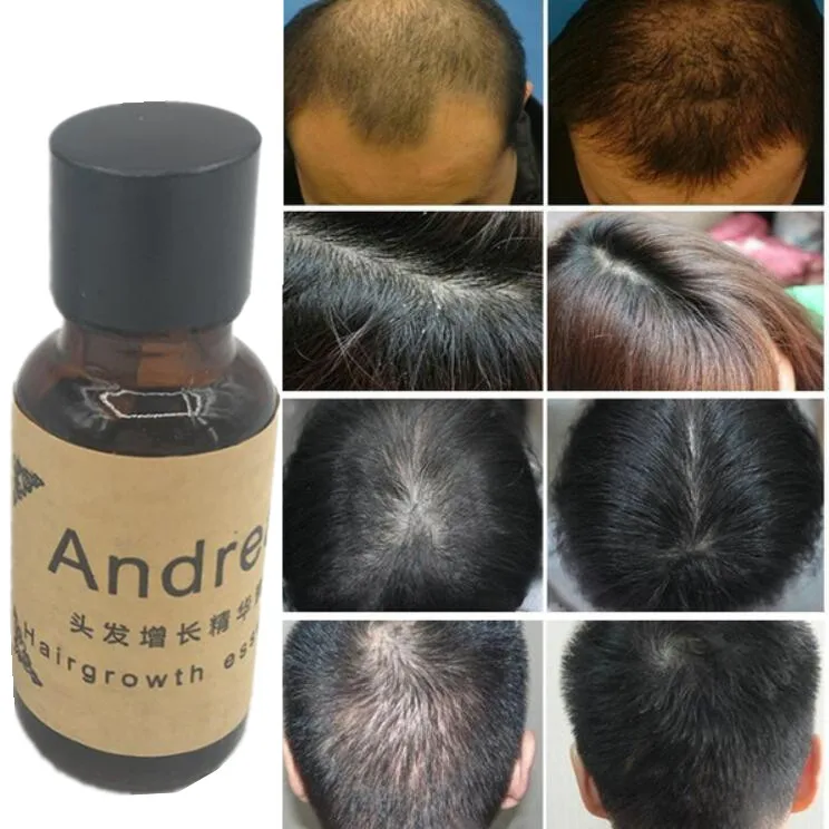 Andrea-Hair-Growth-Ginger-Oil-Natural-Plant-Essence-Faster-Grow-Hair-Tonic-Toppies-Shampoo-No-Hair