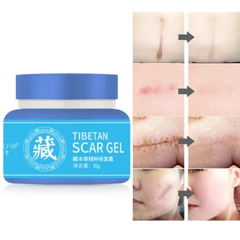 

Scar Gel Nourishing Skin Lightening Pigment Softening Keratin Scar Removal Repair Cream