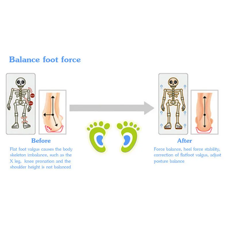 1 пара профессиональных ортопедических Arch Поддержка стельки Плоскостопие плоскостопие корректор Чистка Подушка вставки горячая
