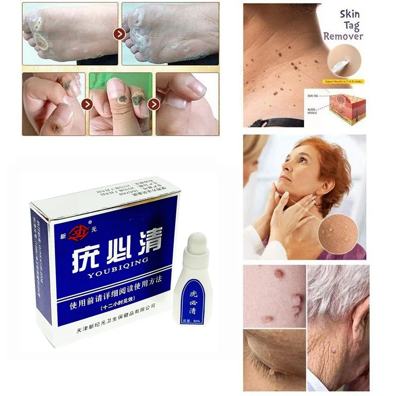 6ml Skin Tag Remover 12 Hours Remover Skin Smooth Care Tag Mole & Genital Wart Remover