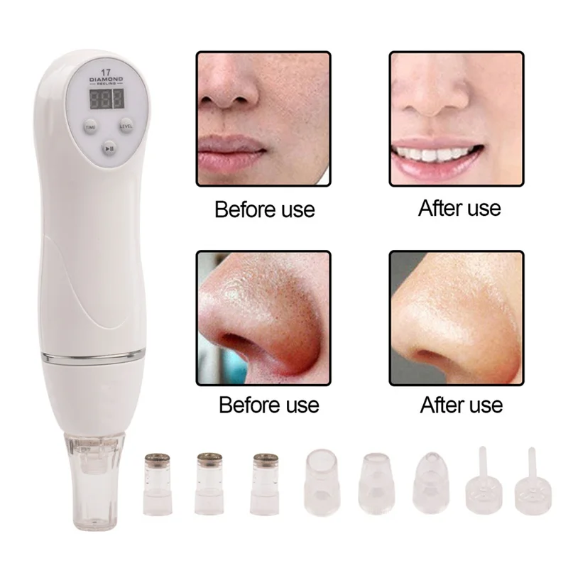 Berlian Perawatan Removal Hot Wajah Massager 6