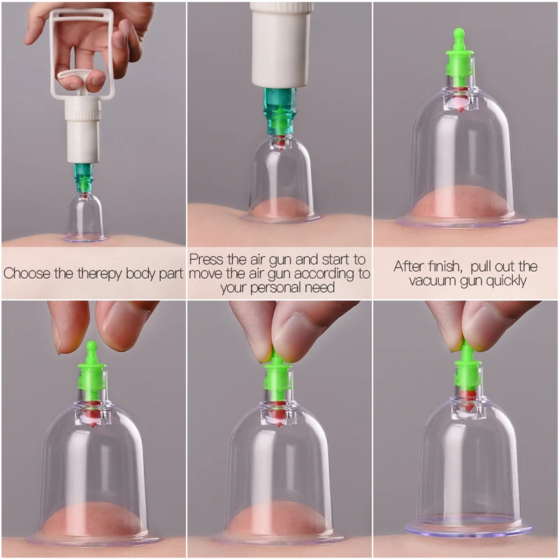 6 шт./пакет Портативный Магнитная терапия Набор вакуумных банок Расслабление Иглоукалывание всасывания Банки газовые баллоны мониторов открывания тянуть