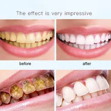 Эффективная отбеливающая ручка для зубов мятный ароматный отбеливающий гель для зубов отбеливатель пятнистый ластик большая улыбка ручка для ухода за зубами