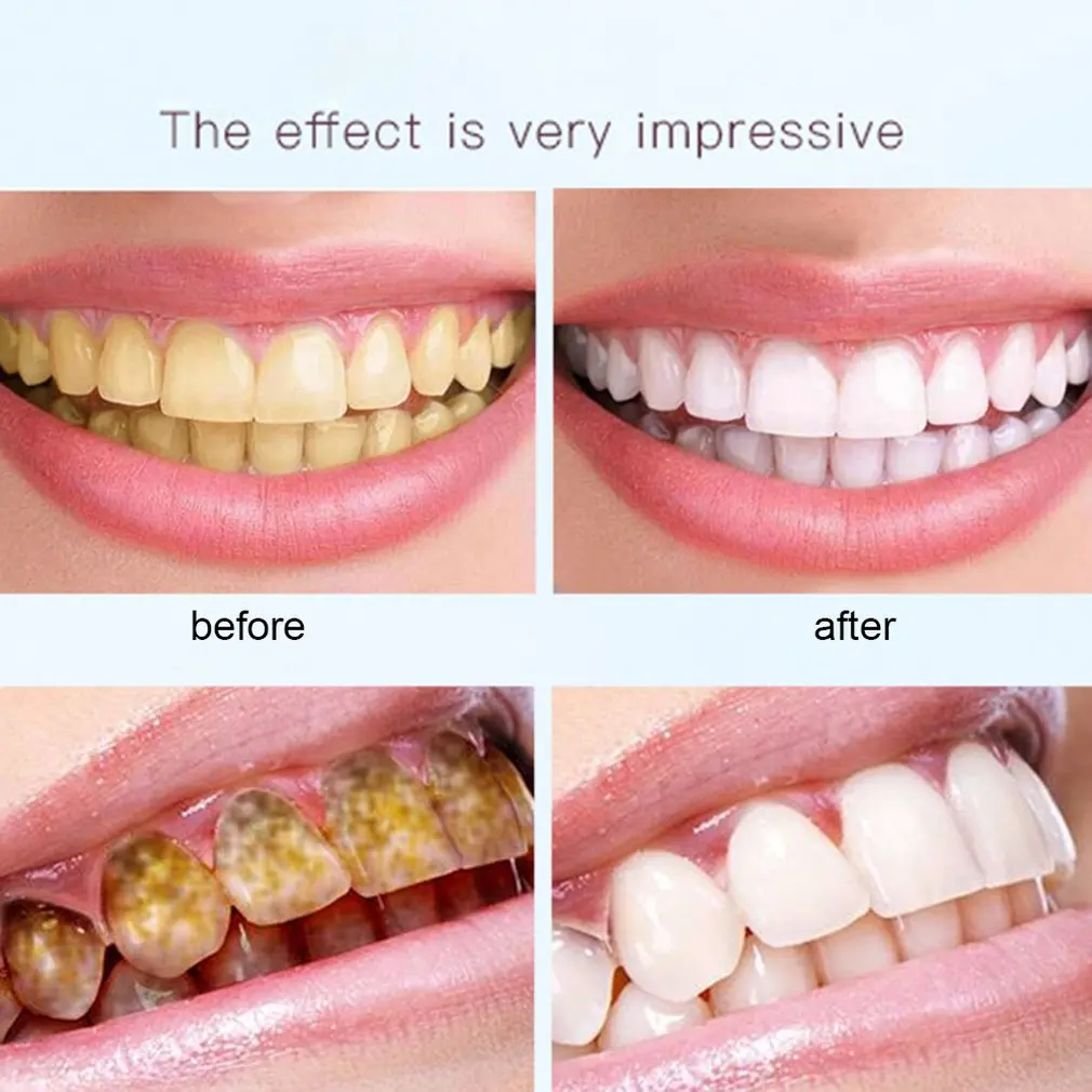 

Effective Teeth Whitening Pen Mint Fragrant Tooth Gel Whitener Bleach Stain Eraser Big Smile Teeth Care Pen
