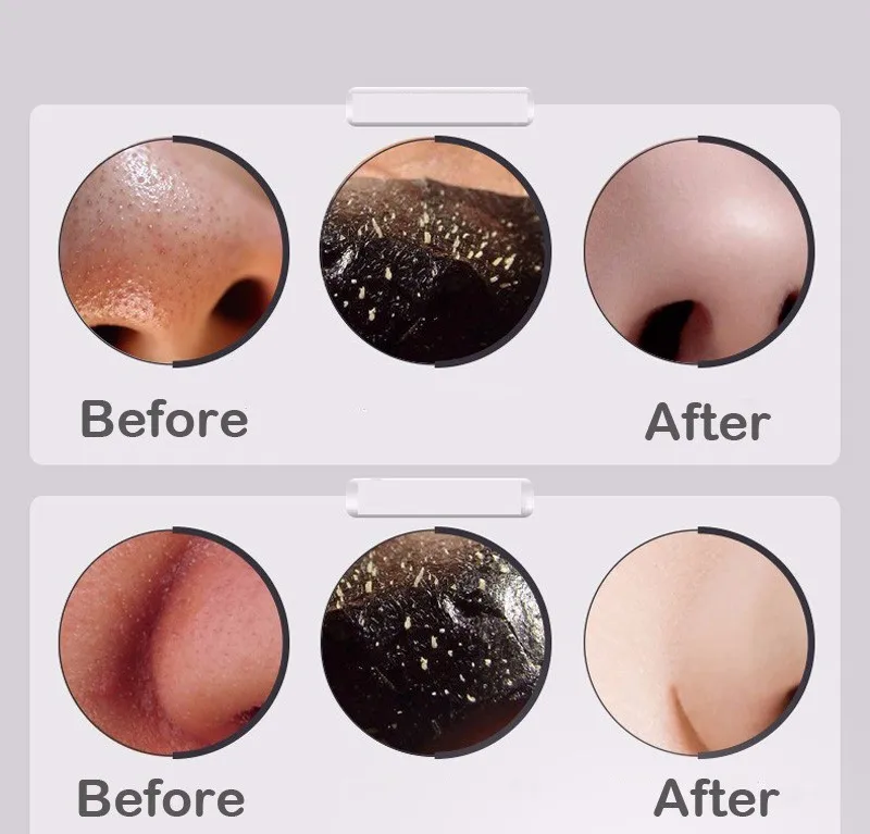 DR. RASHEL черная маска для лица средство удаления угрей древесный уголь