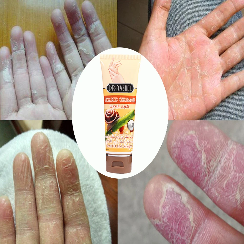 

Snail Serum Repair Hand Cream Nourishing Hand Care Anti Chapping Anti Aging Whitening Firming Hand Cream Skin Care Beauty
