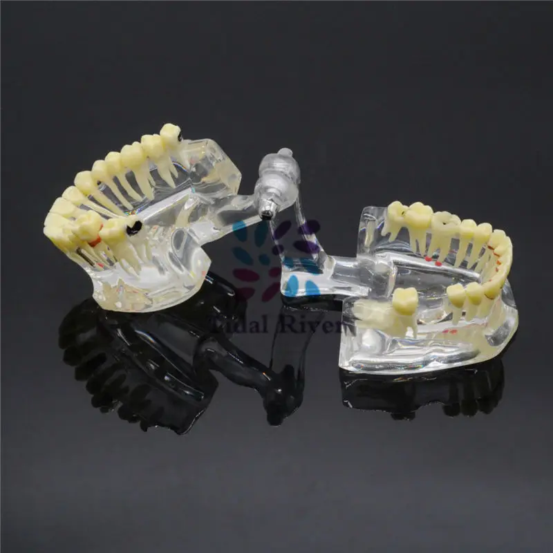 F-D-AL-016--4001-04