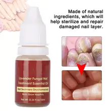 10 мл Лавандовый ремонт ногтей эфирное масло грибковый онихомикоз Удаление лечение ногтей Удаление грибка инфекция ног Уход за ногтями