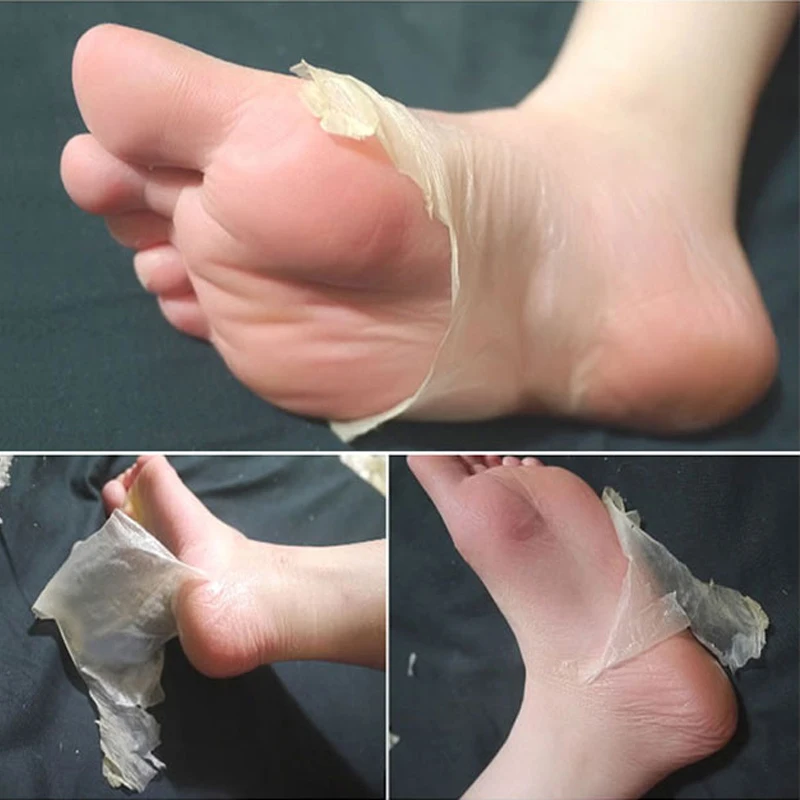 (3)