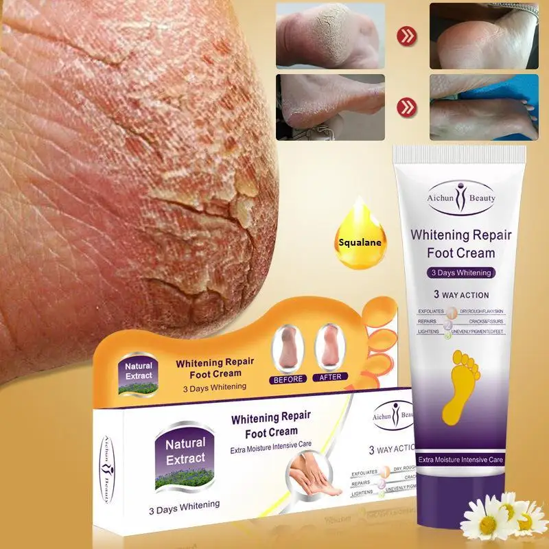 2pc Effective Crack Heel Cream Repair Anti Crack Whitening Cream Foot Peeling Cracked Hand Feet