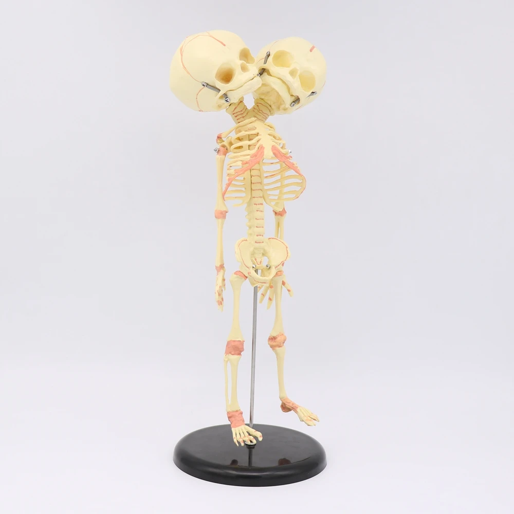 35 см двуглавый Череп Человек Новорожденный ребенок двойная Голова Череп для изучения анатомии Скелет анатомический мозг образование анатомическая модель исследования