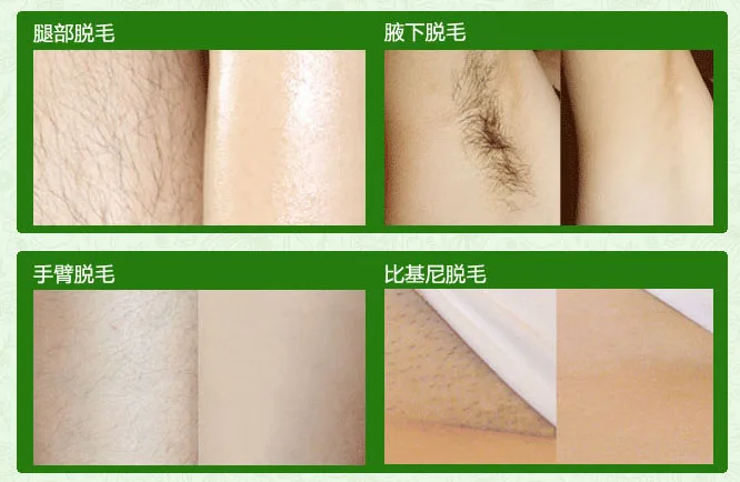 Italy Strep Men S And Women S Special Hair Removal Depilatory