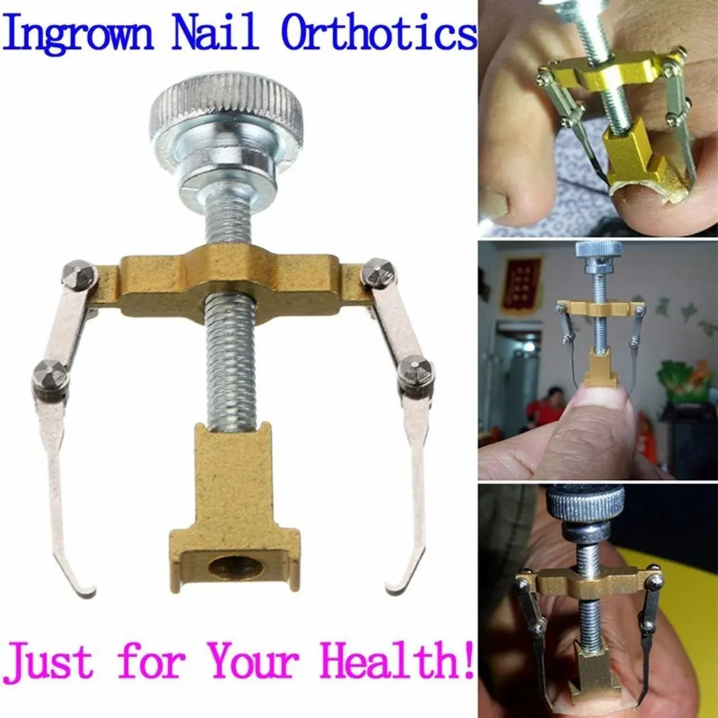 Ingrown Toe Nail Correction Tool Manicure Clipper Pedicure Fixer Recover Pro Foot Nail Care Orthotic Nail Bunion Corrector
