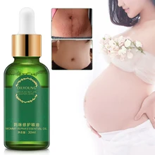 Восстанавливающее масло от растяжек, питательная кожа, быстро удаляет растяжки, уход за кожей для беременных женщин